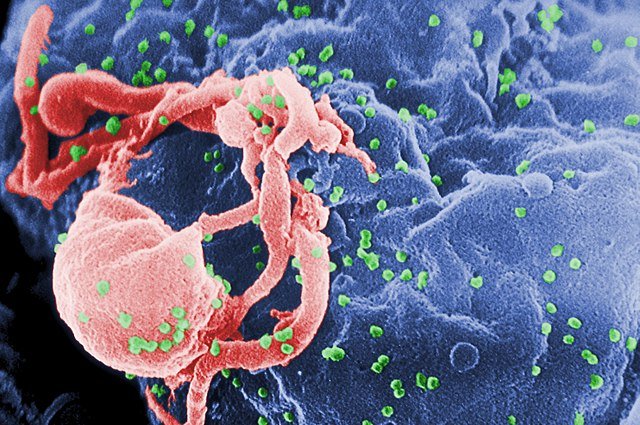 640px-HIV-budding-Color